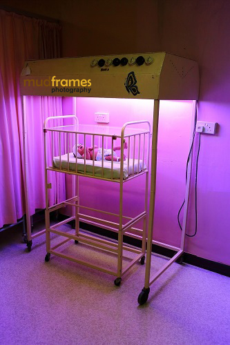 An old baby cot with a jaundiced baby under an old Phototherapy machine in Assunta Hospital's Nursery